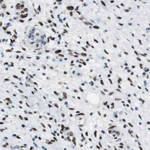 PGM2 antibody|PGM2抗体