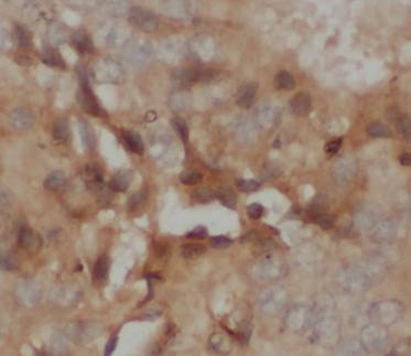 GSTM1 antibody|GSTM1抗体 FNab099