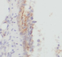 PLAU antibody|PLAU抗体