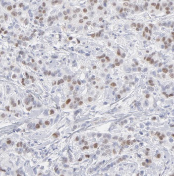 TBX18 antibody|TBX18抗体