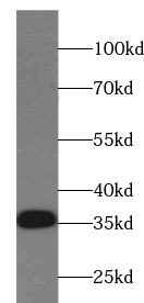 TSFM antibody|TSFM抗体