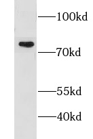 LSG1 antibody|LSG1抗体