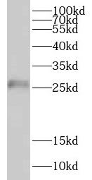 CRISP2 antibody|CRISP2抗体
