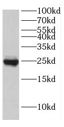 EIF4E3 antibody|EIF4E3抗体