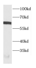 CBFA2T3 antibody|CBFA2T3抗体