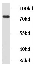 PLD1 antibody|PLD1抗体