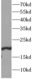 SKP1 antibody|SKP1抗体 FNab10039