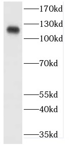 CDH20 antibody|CDH20抗体