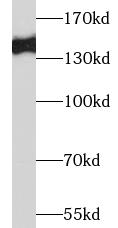 NOS3 antibody|NOS3抗体 FNab09945