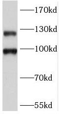 GRM2 antibody|GRM2抗体 FNab05167