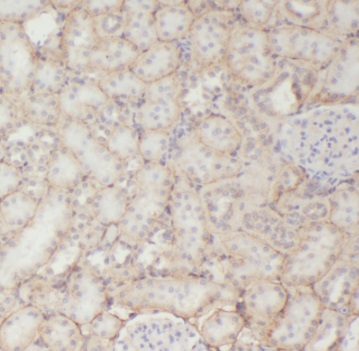 TPI1 antibody|TPI1抗体 FNab08886