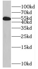 SPATS2L antibody|SPATS2L抗体