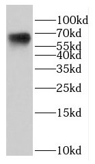 DTNB antibody|DTNB抗体