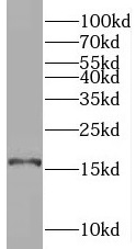 SYNJ2BP antibody|SYNJ2BP抗体