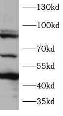 TP73 antibody|TP73抗体