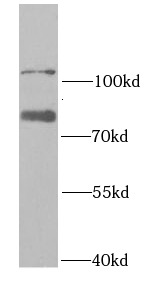 RAD18 antibody|RAD18抗体