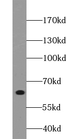VPS45 antibody|VPS45抗体 FNab094