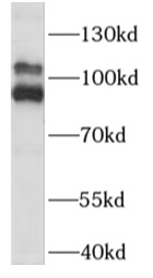 PLA2G4B antibody|PLA2G4B抗体 FNa