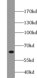 TRIM29 antibody|TRIM29抗体