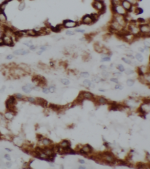 DNAH17 antibody|DNAH17抗体