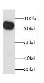 CAPN11 antibody|CAPN11抗体