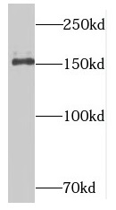 NUP153 antibody|NUP153抗体