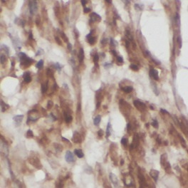 TRAF5 antibody|TRAF5抗体 FNab100