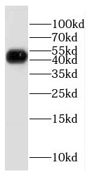 ETF1 antibody|ETF1抗体