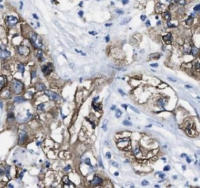 AK2 antibody|AK2抗体 FNab00244