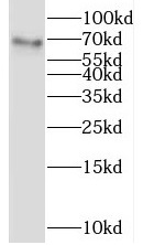 LGALS3BP antibody|LGALS3BP抗体 F