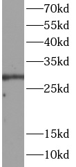 DDIT3 antibody|DDIT3抗体 FNab100