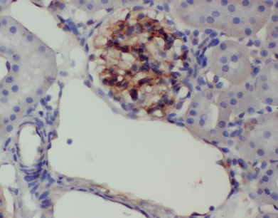 ANKRD6 antibody|ANKRD6抗体