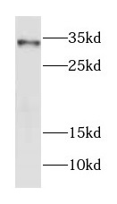 FOXE3 antibody|FOXE3抗体
