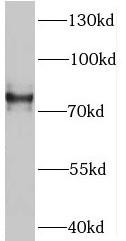 SV2B antibody|SV2B抗体
