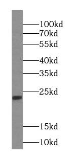 IMP3 antibody|IMP3抗体 FNab04297