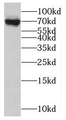 NUMB antibody|NUMB抗体 FNab05913