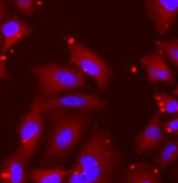 TPP2 antibody|TPP2抗体 FNab08895