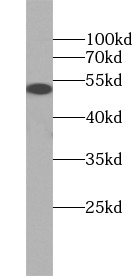 GFAP antibody|GFAP抗体 FNab03428