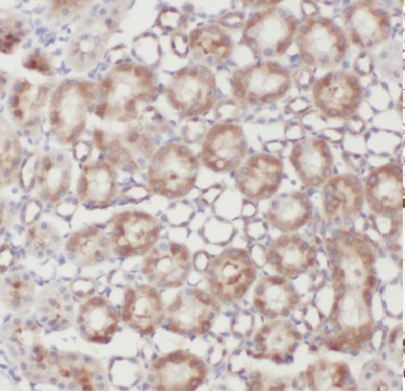 CWF19L2 antibody|CWF19L2抗体