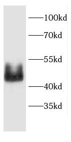 CD24 antibody|CD24抗体 FNab01449