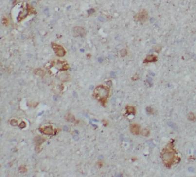 CAMK2A antibody|CAMK2A抗体