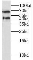 NECTIN4 antibody|NECTIN4抗体