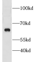 CNKSR3 antibody|CNKSR3抗体