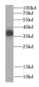 CPOX antibody|CPOX抗体 FNab01869
