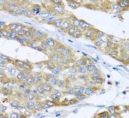 COQ7 antibody|COQ7抗体