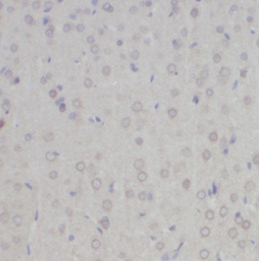 NYAP2 antibody|NYAP2抗体