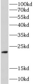 PLN antibody|PLN抗体