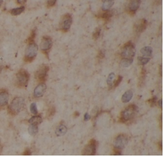 SLC17A7 antibody|SLC17A7抗体