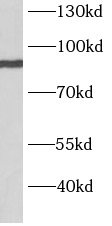 BARD1 antibody|BARD1抗体