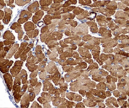 LIMK1 antibody|LIMK1抗体